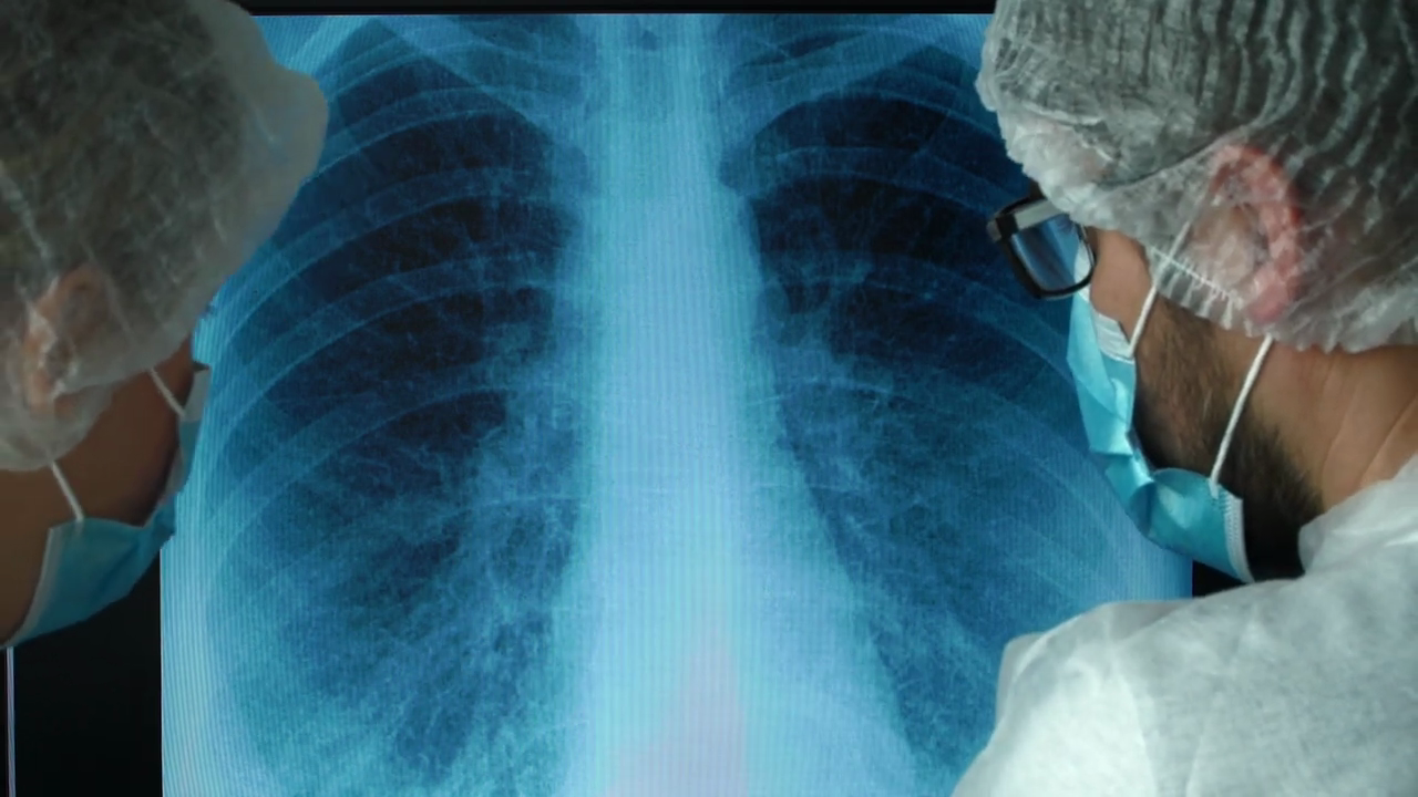 Reducing Pneumonia Burden