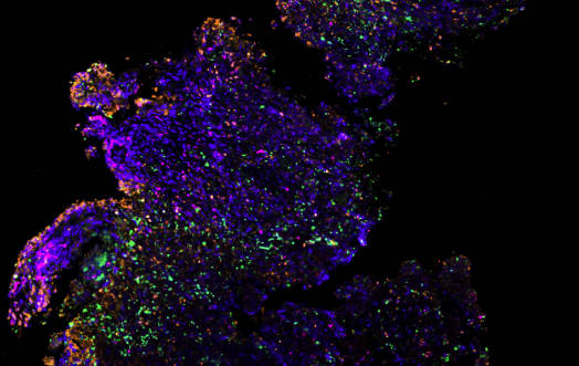 Kulkarni Lab’s work highlighted by the International Complement Society (March 2023)
